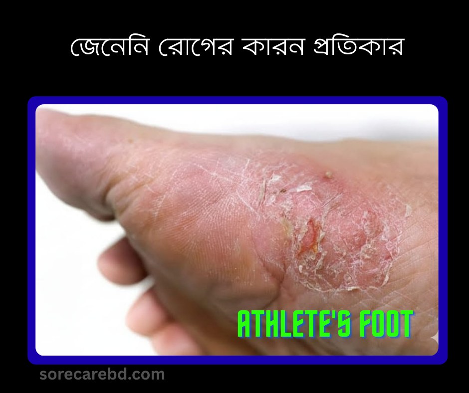 আপনার পায়ের চামড়া কি এভাবে উঠে যাচ্ছে অবহেলা করলে বিপদ বাড়তে পারে